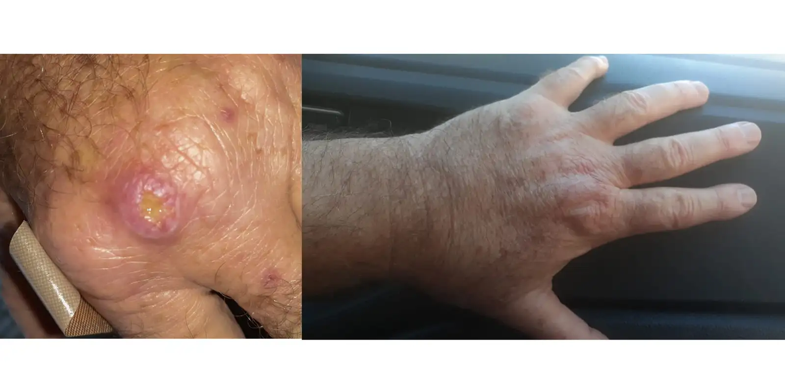 especialistas-alertam-para-a-falta-de-informacao-sobre-a-leishmaniose