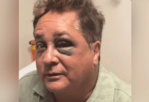 leonardo-sofre-queda-no-pantanal-e-esposa-atualiza-estado-de-saude-do-cantor