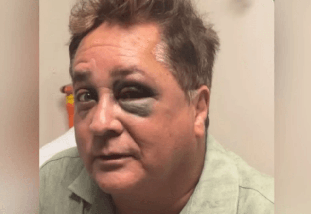 leonardo-sofre-queda-no-pantanal-e-esposa-atualiza-estado-de-saude-do-cantor