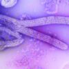 Potencial pandêmico do Ebola é diferente da Covid-19, diz infectologista