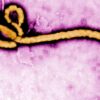 Suspeita de Ebola é descartada em paciente do Rio vindo de Uganda