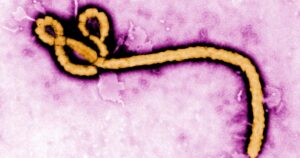 suspeita-de-ebola-e-descartada-em-paciente-do-rio-vindo-de-uganda