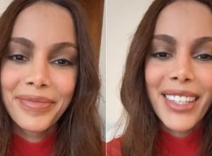 anitta-se-pronuncia-apos-novos-procedimentos-esteticos-no-rosto-e-lamenta-comentarios