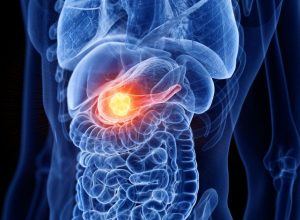 estudo-revela-proteina-ligada-ao-avanco-do-cancer-de-pancreas-pelos-nervos