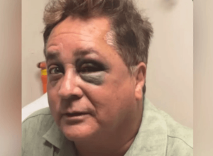 leonardo-sofre-queda-no-pantanal-e-esposa-atualiza-estado-de-saude-do-cantor