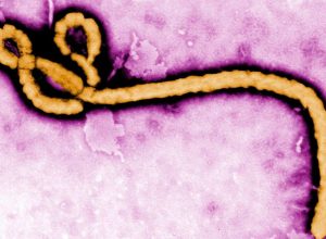 suspeita-de-ebola-e-descartada-em-paciente-do-rio-vindo-de-uganda